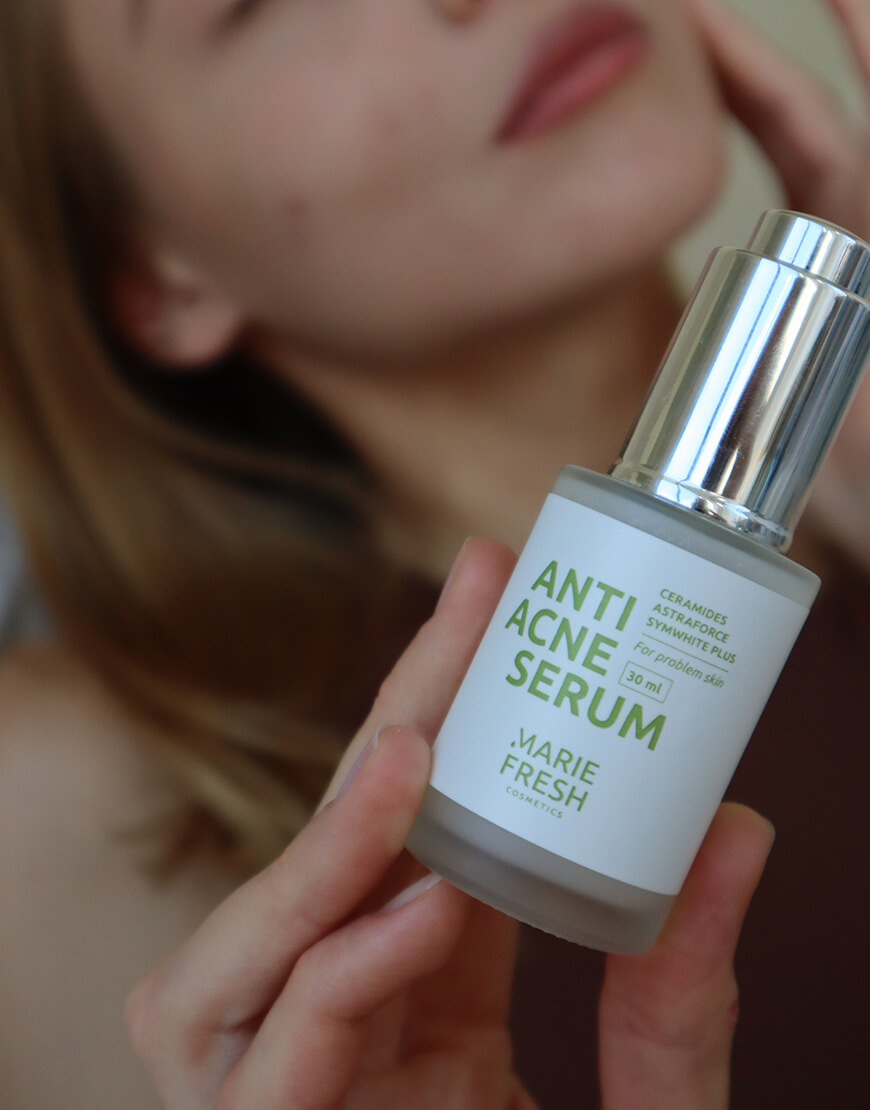 IMG_2875 Сироватка Anti Acne Marie Fresh з AHA кислотами для проблемної шкіри 30 мл MARIE FRESH COSMETICS (MRFC_saa-1-30) - фото 9